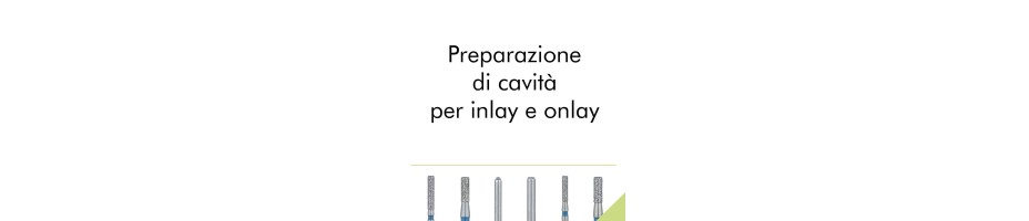Preparazione di cavita' per inlay e onlay