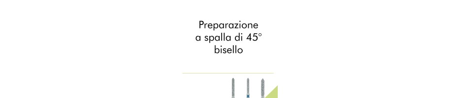 Preparazione a spalla di 45 gradi, bisello