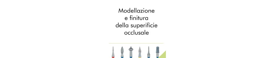 Modellazione e finitura della superificie occlusale